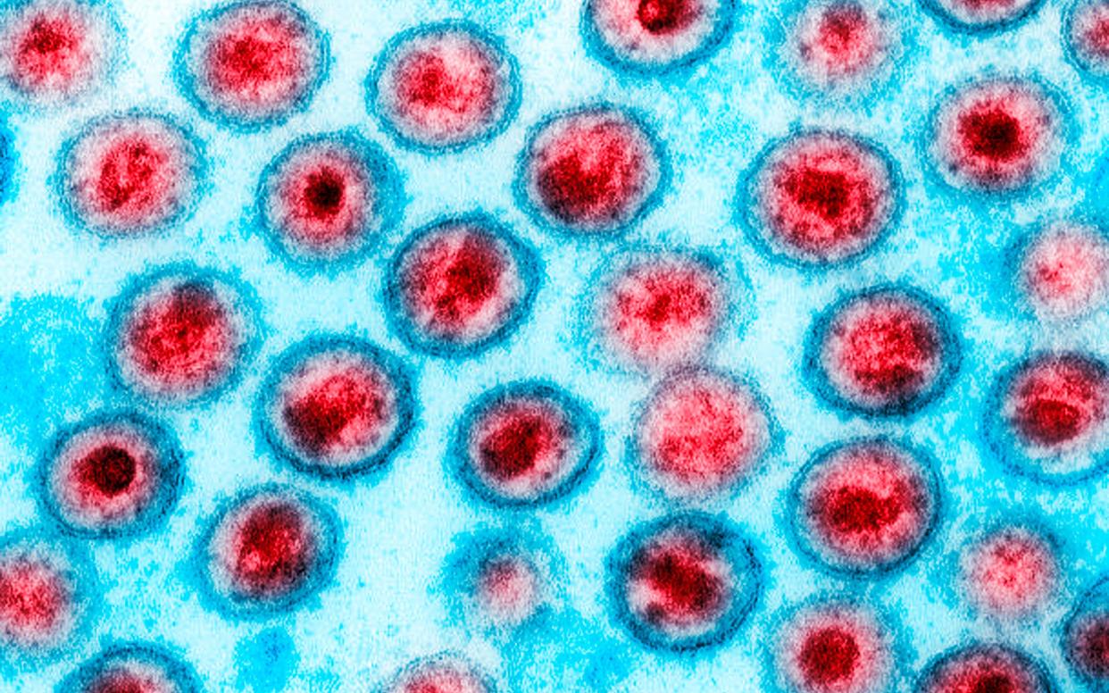 HIV 1 AIDS transmission electron micrograph virus particles - Scott Camazine/Alamy