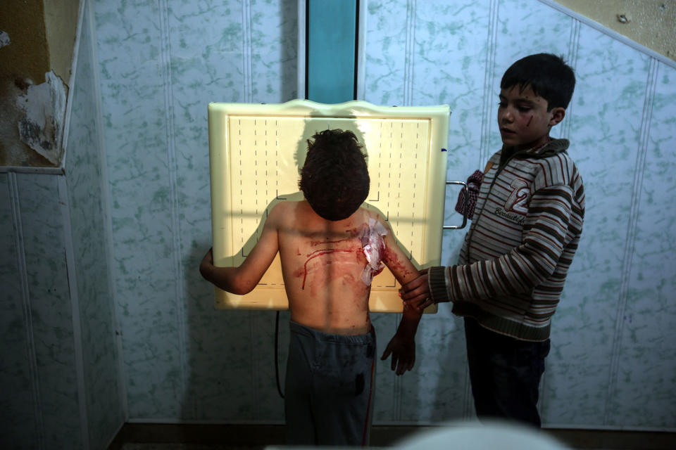 Injured boys in Douma, Syria