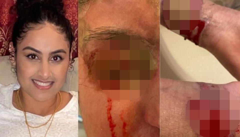 Pictured on the left is Nafiah Ikram before the attack and on the right are two blurred images of her injuries after the attack.