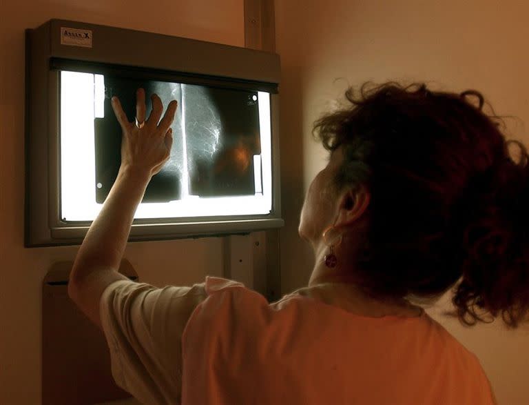 Una mamografía cada dos años evita casi una de cada tres muertes por cáncer de mama