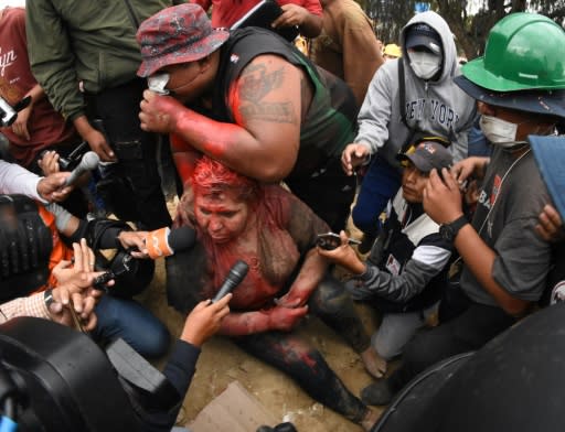 The mayor of the Bolivian town of Vinto, Patricia Arce, speaks to the press as she is being humiliated by a mob of opposition supporters who forcibly cut her hair and covered her in paint