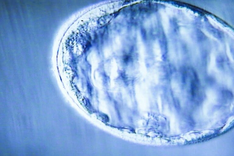 Cuando se definió la regla de los 14 días, en 1978, los embriones no sobrevivían más de 5 o 6 días en un laboratorio (y tenían la forma que ves en esta imagen)