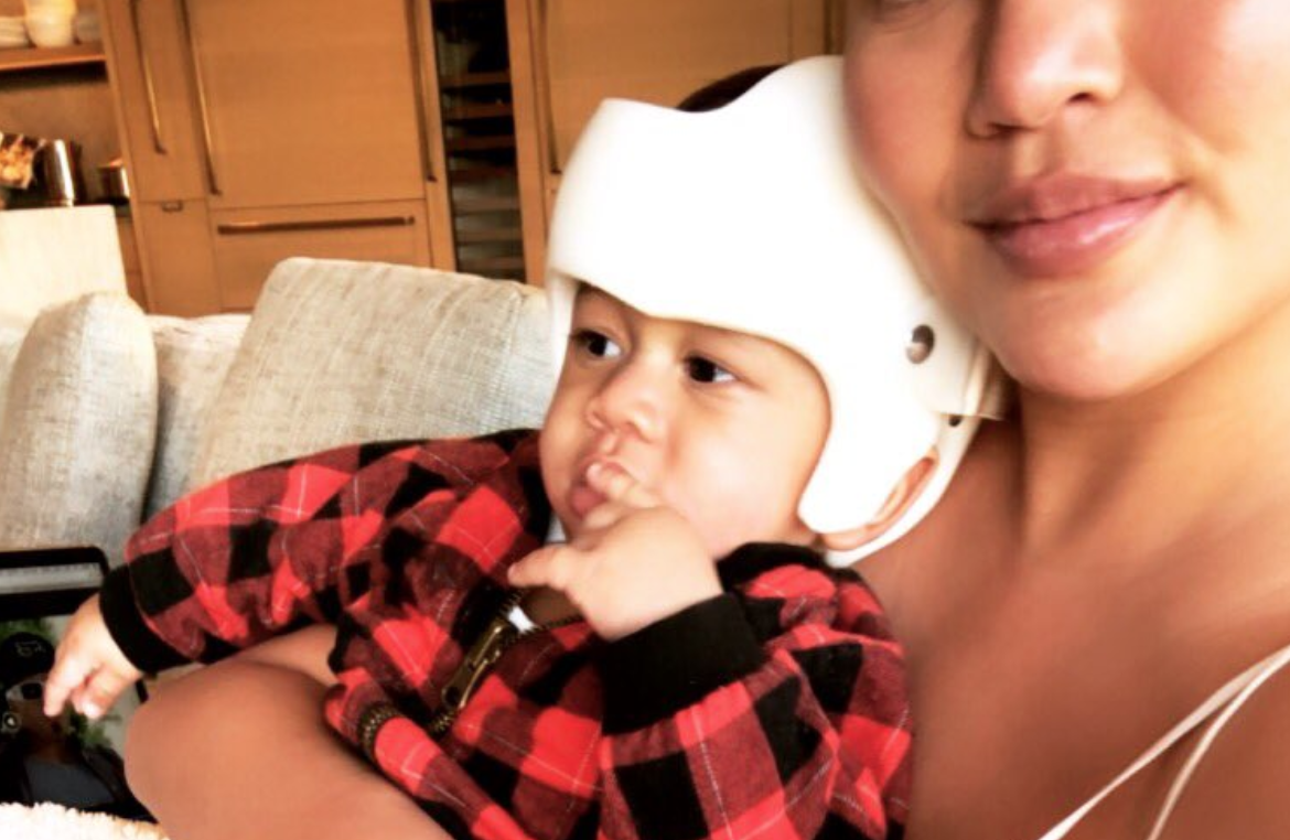 Chrissy Teigen and John Legend’s son, Miles, rocking his new corrective helmet. (Photo: Twitter)