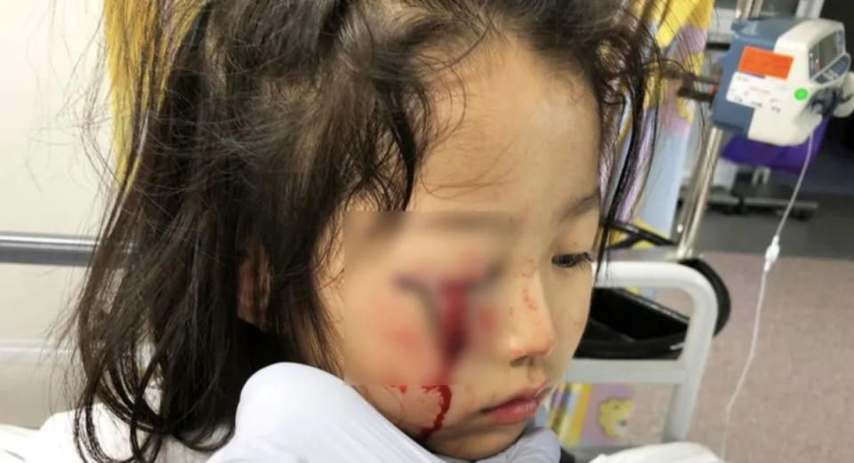 Young Kmart shopper's eye injury