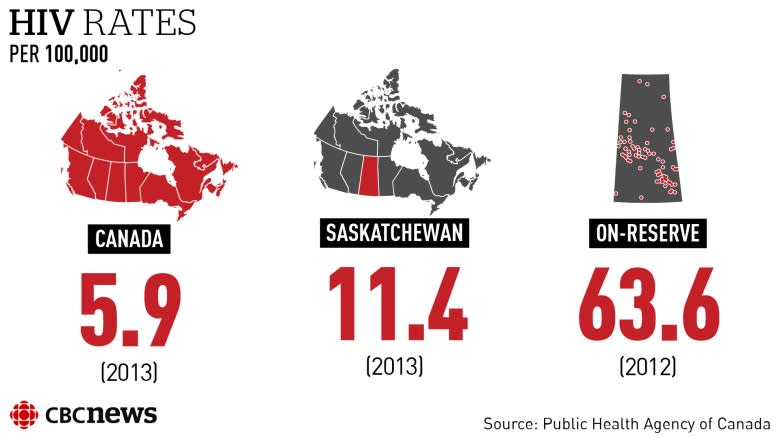 HIV epidemic sweeping Saskatchewan reserves