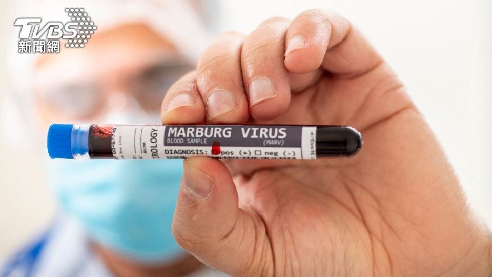 目前還沒有針對馬堡病毒的疫苗及治療藥物。（示意圖／shutterstock達志影像）