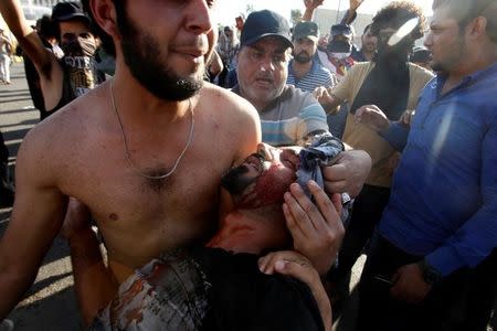 Anti-government protesters carry an injured man as they storm Baghdad's Green Zone in Iraq May 20, 2016. REUTERS/Khalid al Mousily