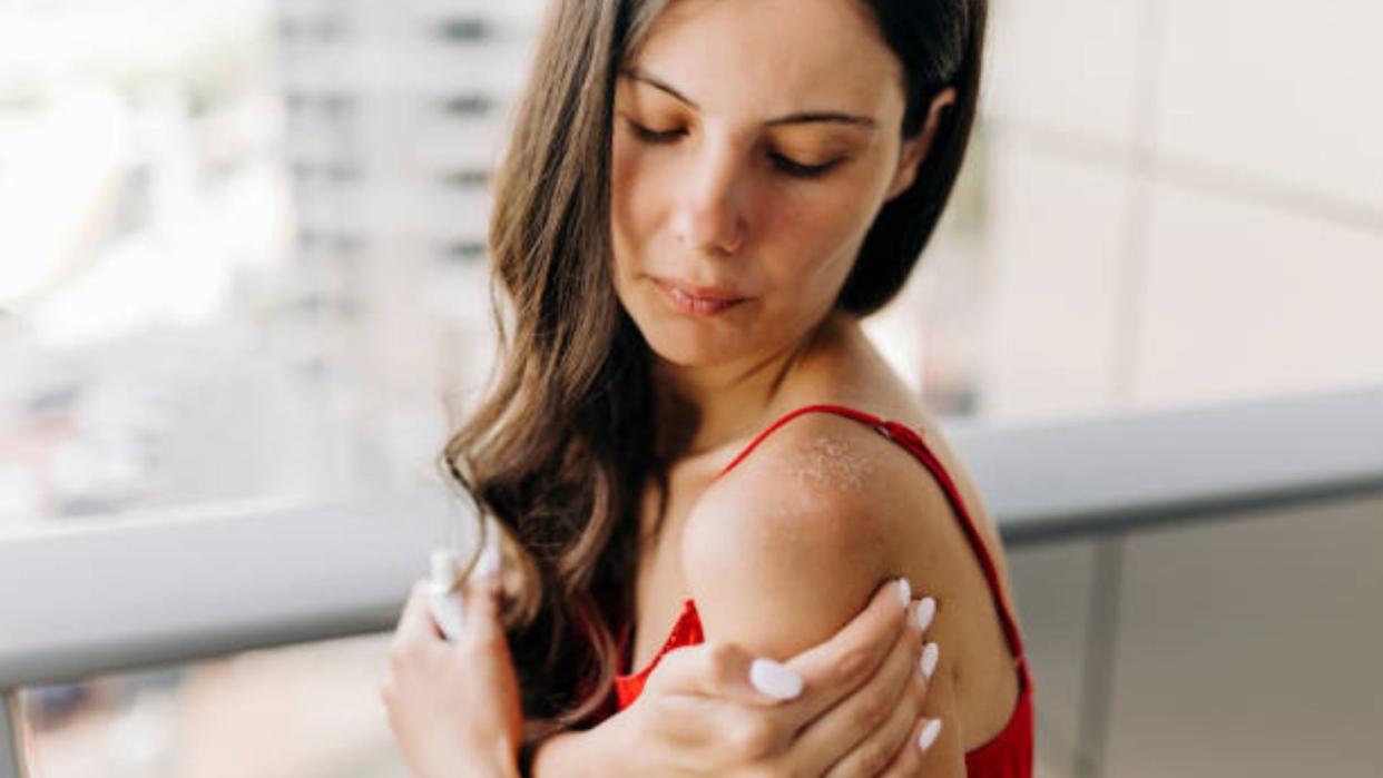  A brunette woman wakes up from her sleep to touch the sunburn on her shoulder. 