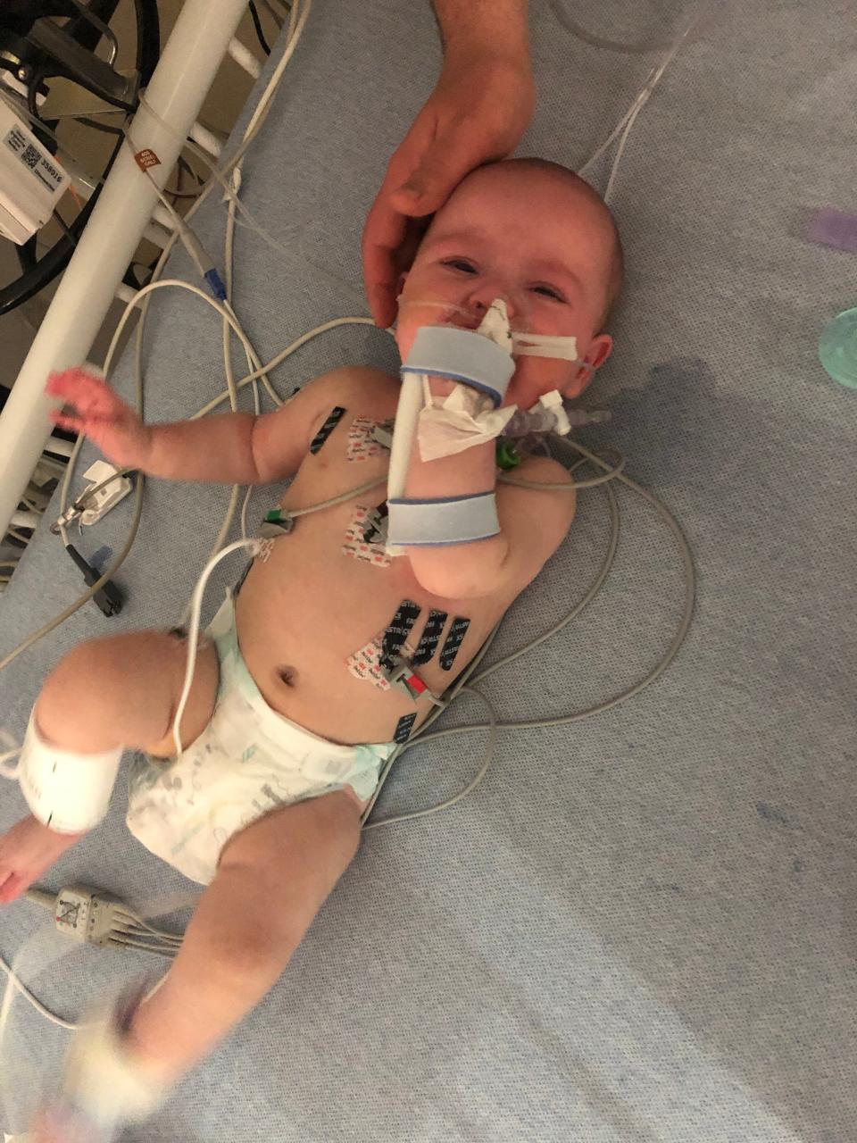 Cleveland Clinic Children's Hospital treats a baby for a COVID-19 complication called multisystem inflammatory syndrome in children, or MIS-C.