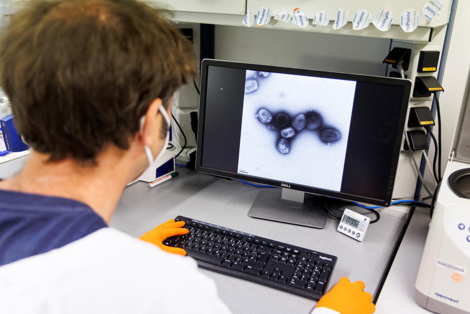 An employee of the vaccine company Bavarian Nordic shows a picture of a vaccine virus on a display in a laboratory of the company in Martinsried near Munich, Germany, May 24, 2022. The company, headquartered in Denmark, is the only one in the world to have approval for a smallpox vaccine called Jynneos in the U.S. and Imvanex in Europe, which is also effective against monkeypox. REUTERS/Lukas Barth 