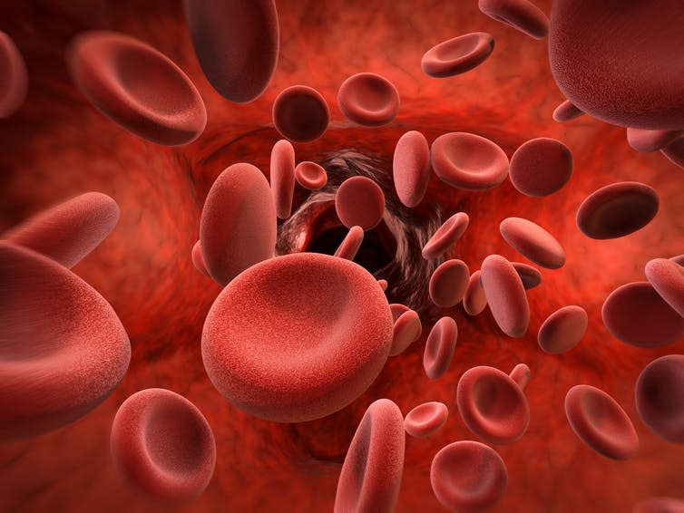 <span class="caption">Cancer stem cells grow in suspension in the bloodstream and spread throughout the body.</span> <span class="attribution"><a class="link " href="https://www.shutterstock.com/image-illustration/3d-rendering-red-blood-cells-vein-517874557?src=BvKWjBwOSlhDO4joRgHq1g-1-5" rel="nofollow noopener" target="_blank" data-ylk="slk:Phonlamai Photo/Shutterstock;elm:context_link;itc:0;sec:content-canvas">Phonlamai Photo/Shutterstock</a></span>