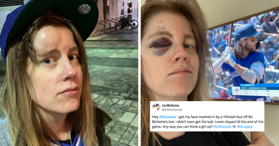 A Blue Jays superfan who went viral after getting knocked in the face by a foul ball this weekend says she’s still in a lot of pain but feels thrilled by how things have turned around as a result of her misfortune