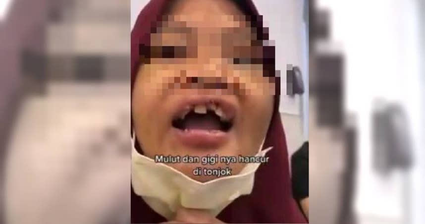 印尼籍女移工遭天母李姓夫妻虐打，更導致牙斷耳聾，雙方最終以100萬元達成和解。（圖／翻攝臉書「天母幫」）