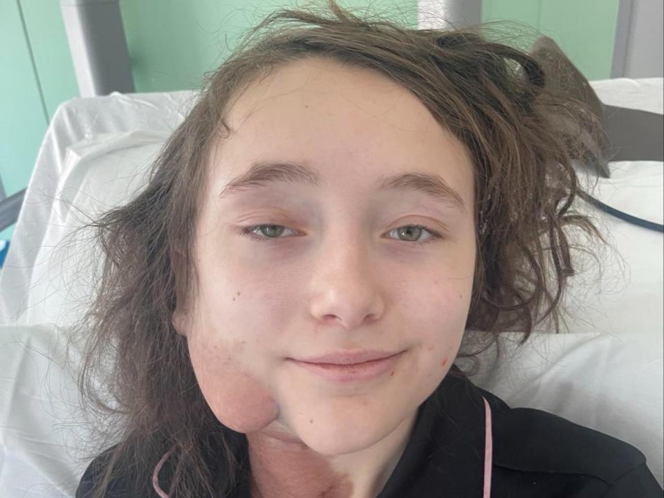 Phoebe Weston, 14, in hospital for her first surgery to remove tumours (Iain Weston)