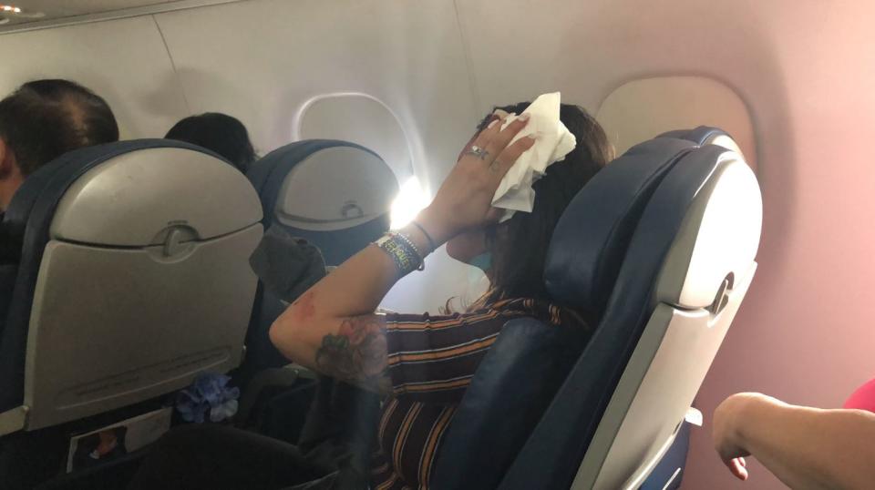 One of the injured passengers on the plane. Source: Twitter/ Barbara Belcher