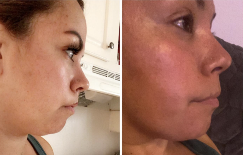 This Amazon customer saw "a dramatic change in my saggy chin and I’m loving it" after using Maryann Organics Neck Firming Cream for just three days.  (Photo: Amazon)