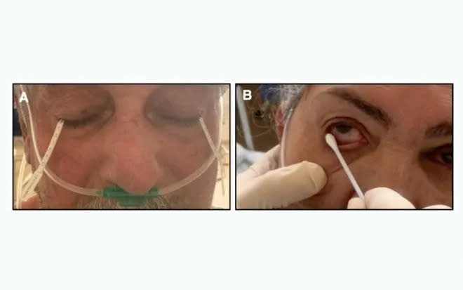 Cientistas da USP criam teste que diagnostica a covid-19 através das lágrimas (Imagem: Luiz Fernando Manzoni Lourençone/USP/Agência Fapesp)