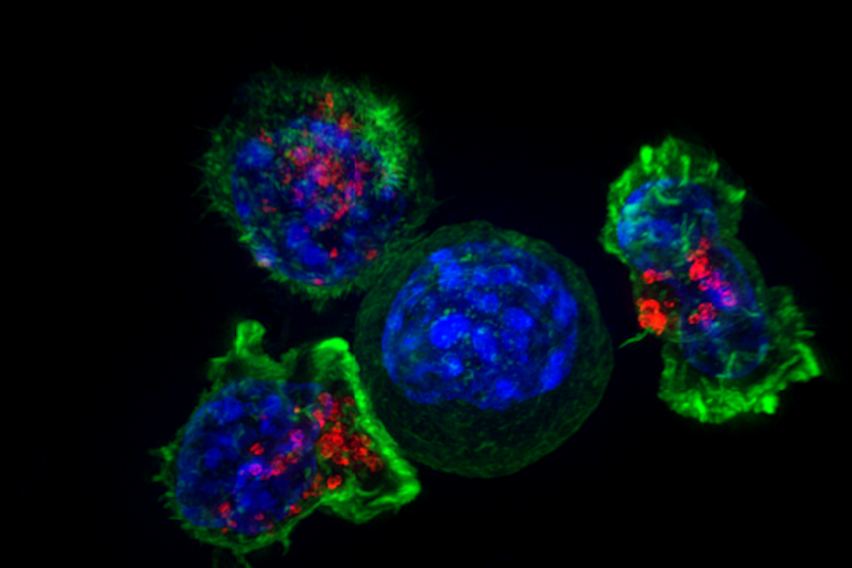 Killer T cells (green and red) can attach to cancer cells (blue, center) and kill them by releasing toxic chemicals (red), a move scientists have dubbed ‘the kiss of death.’ <a href="https://flic.kr/p/xuSZkh" rel="nofollow noopener" target="_blank" data-ylk="slk:NIH/Flickr;elm:context_link;itc:0;sec:content-canvas" class="link ">NIH/Flickr</a>