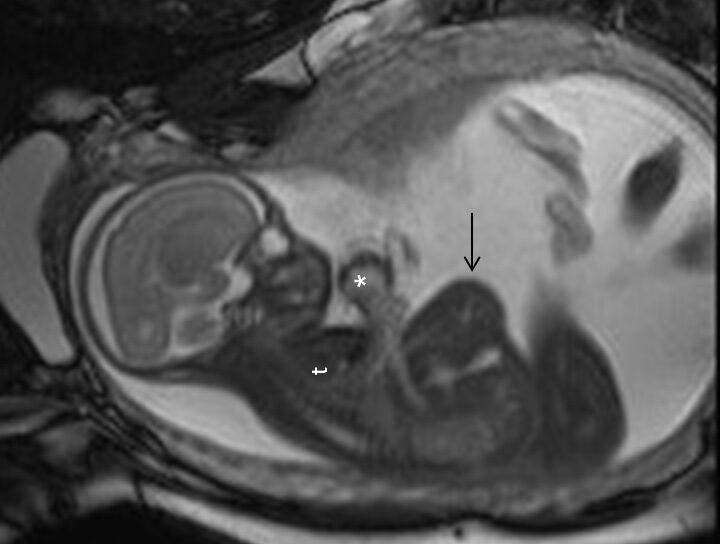 Head, X-Ray, Medical Imaging X-Ray Film