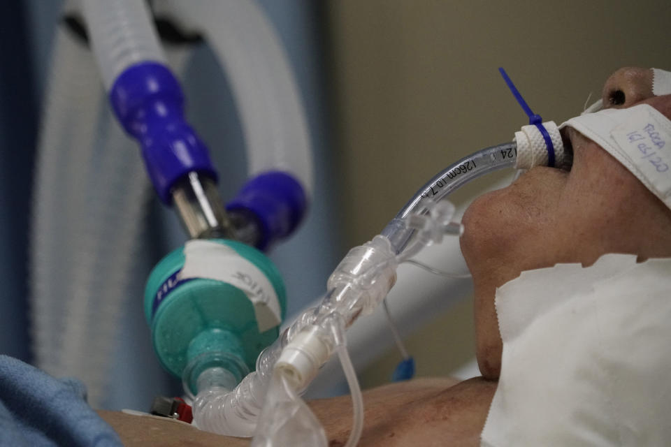 An intubated COVID-19 patient rests at the Sao Jose municipal hospital, in Duque de Caxias, Brazil, Saturday, May 16, 2020. (AP Photo/Yesica Fisch)
