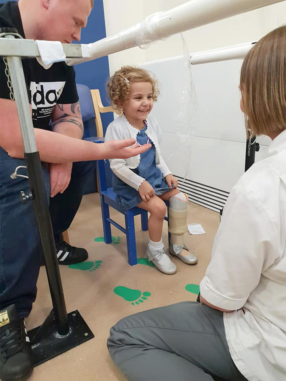 Prosthetic leg for young girl: Marnie Allen-Tomlinson, 3, (pictured) was fitted with a prosthetic leg. 