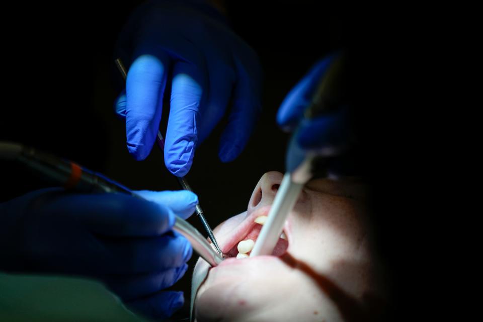 Danielle Wilkes is seen by a dentist during a clinic visit Thursday, Sept. 7, 2023, in Nashville, Tenn. Wilkes waited five years to have her teeth repaired after getting several teeth knocked out in a car wreck. She was able to receive dental care after an expansion of the state's Medicaid program.