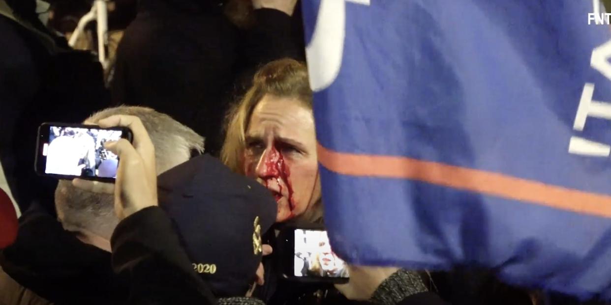 Therese Duke bloody face after punch protest DC