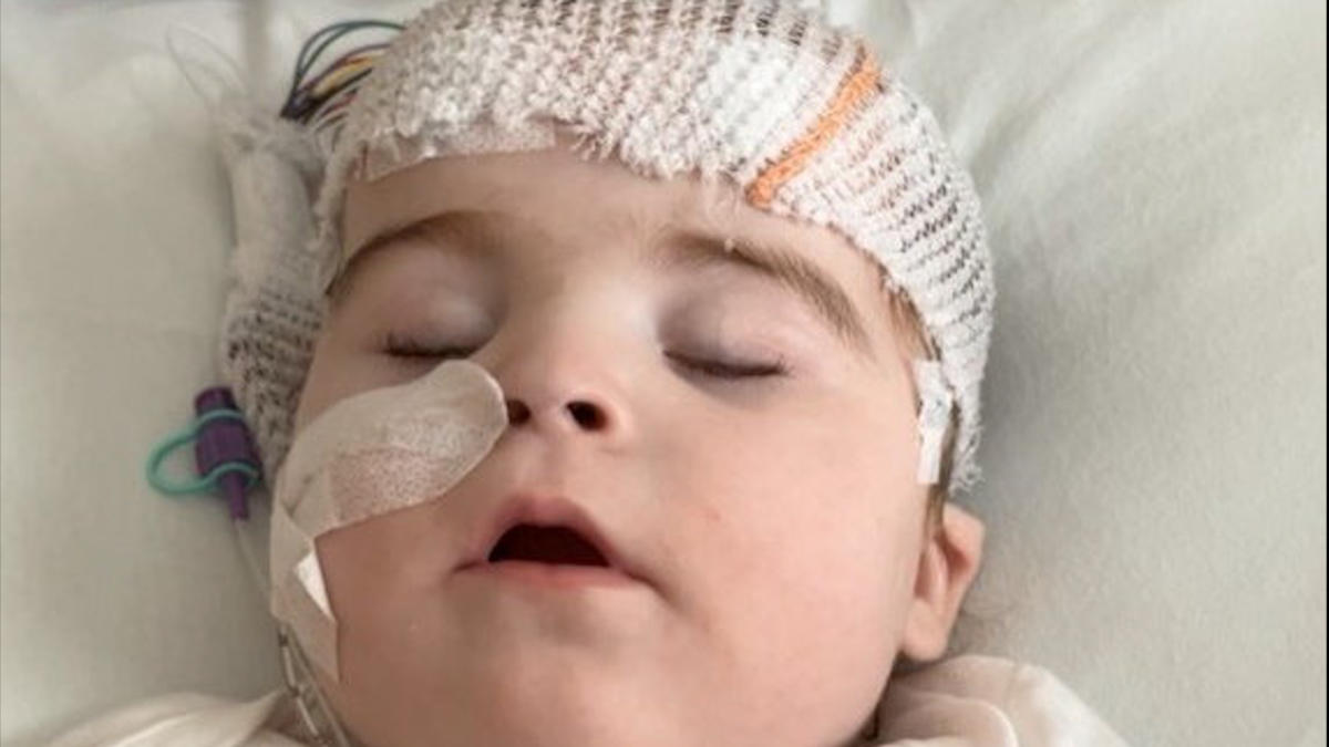 Tot is the only child in the world with rare condition and has 34 seizures a day