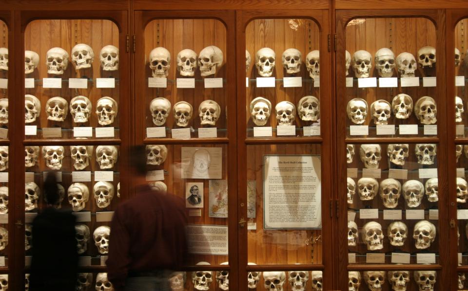 In this Oct. 7, 2004, photo, Professor Huyrl's skull collection was used to study the shapes of the skull and was donated to Philadelphia's Mutter Museum in 1875. The museum is facing ethical issues about the display of human remains from the 19th and 20th centuries.