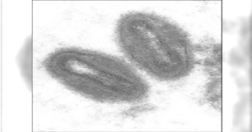電子顯微鏡下的猴痘病毒。（圖／維基百科）