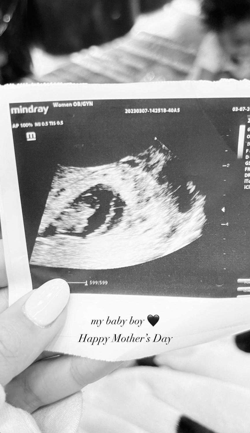 Alexis Gale/instagram Alexis Gale holds ultrasound photo