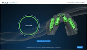 Upon uploading a patient’s scans of 2.0 Scan gauges in both Left to Right and Right to Left sequences and following a few steps, a dentist will receive one of three outcomes: SUCCESS, CONSIDER RESCAN, SCAN FAILURE. Above is an example of a successful scan that passed alignment analysis, allowing a dentist to confidently continue to order a Nexus prosthesis.