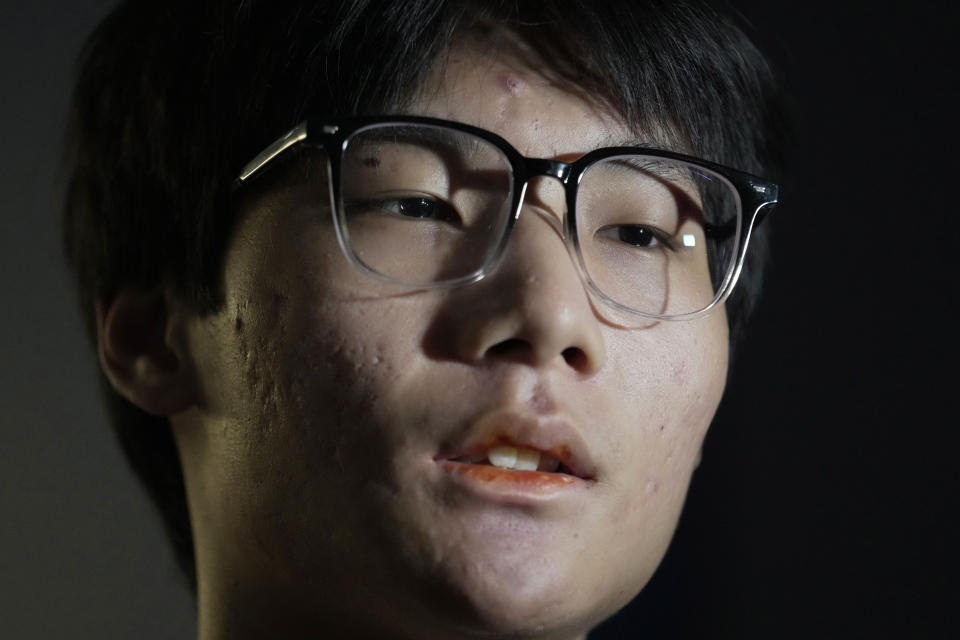 Gao Peng, son of Chinese dissident Gao Zhi, speaks during an interview with The Associated Press in Bangkok, Thailand, on July 17, 2023. Since landing in Thailand July 3, he says he has been accused of making bomb threats, put on an EU travel blacklist, and seem his mother and 16-year-old sister detained and threatened with deportation back to China. The threats, made in the family's names against airports, luxury hotels and the Chinese embassy in Bangkok derailed their plans to join Gao Zhi in the Netherlands. (AP Photo/Sakchai Lalit)