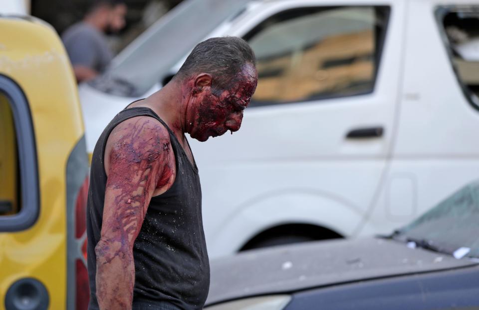 Las imágenes del después tras la explosión trágica en Beirut