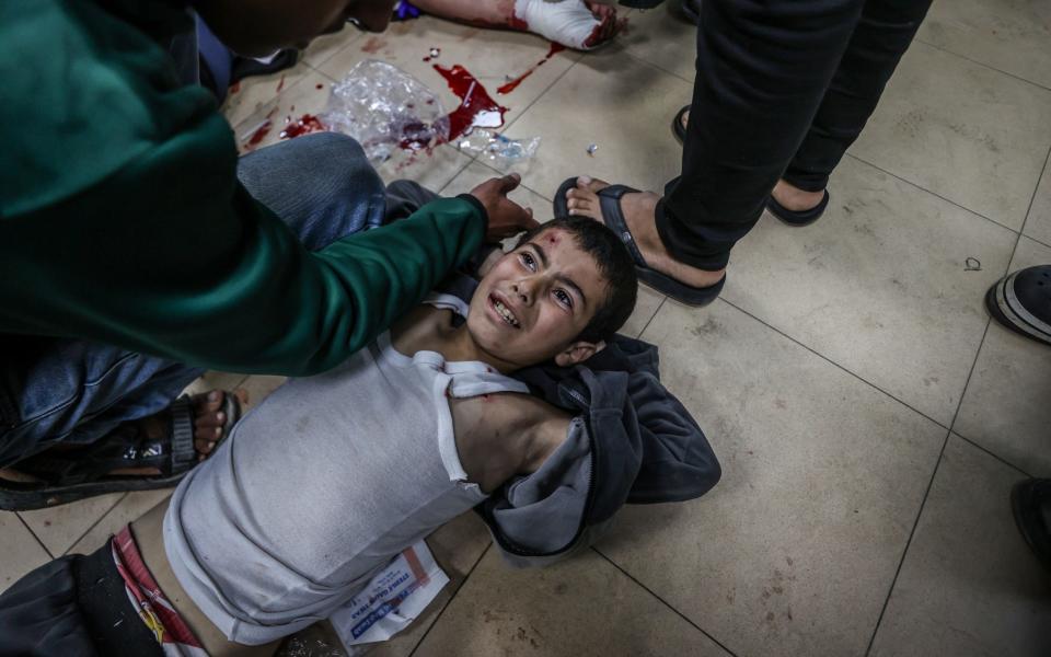 Injured Palestinians, including children, are brought to Al-Aqsa Martyrs Hospital