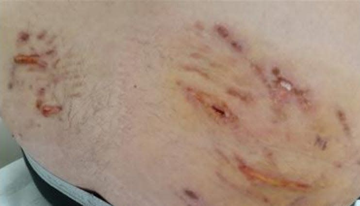 A photo of Raymond Rubio's injuries during a January 2020 arrest by Visalia police.