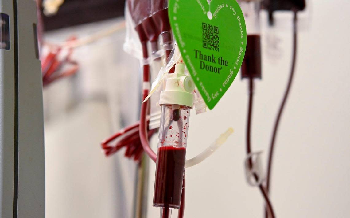 Some of the donated blood given to sickle cell patient Kevin Wake during a recent transfusion at University Health.
