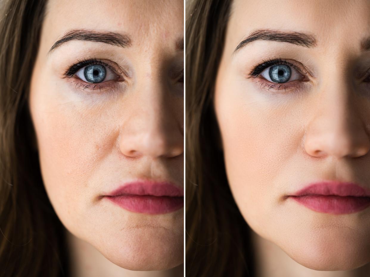 woman before and after retouching