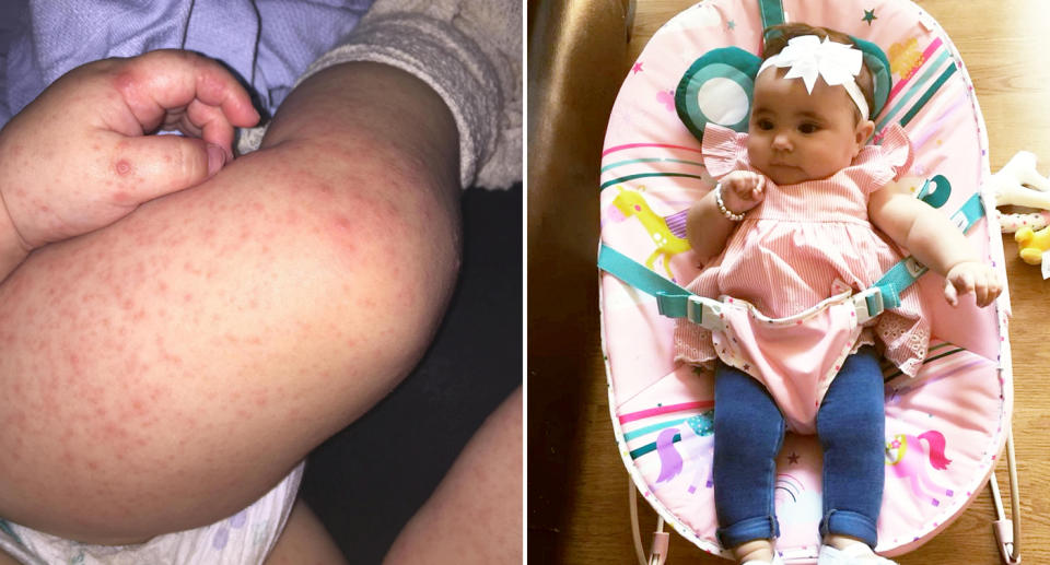 The 21-year-old mother said her baby broke out in a rash but the medical staff at Basildon hospital didn’t care. Image: SWNSW