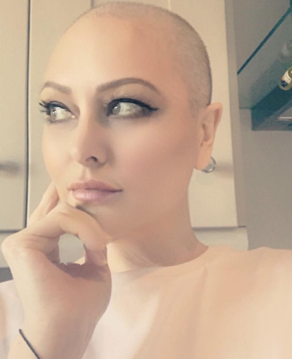 Lyndsey Proctor after chemo treatment 'on a good day'.