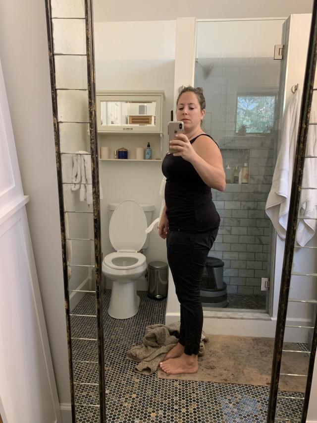 I was never ashamed of my wiggly, magical belly after having three kids and  losing 130lbs - but I'm so happy with my tummy tuck