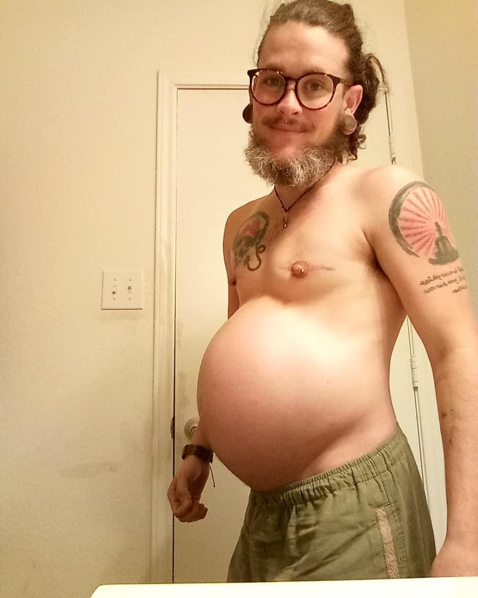 A transgender man is opening up about giving birth. (Photo: Caters News)