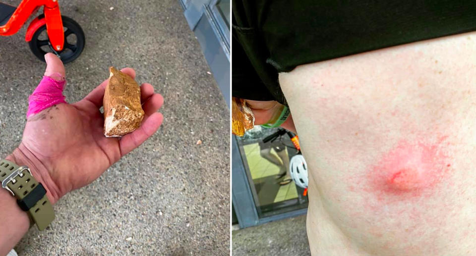 A Woolworths store in Darwin city was pelted with rocks, leaving customers with welts.