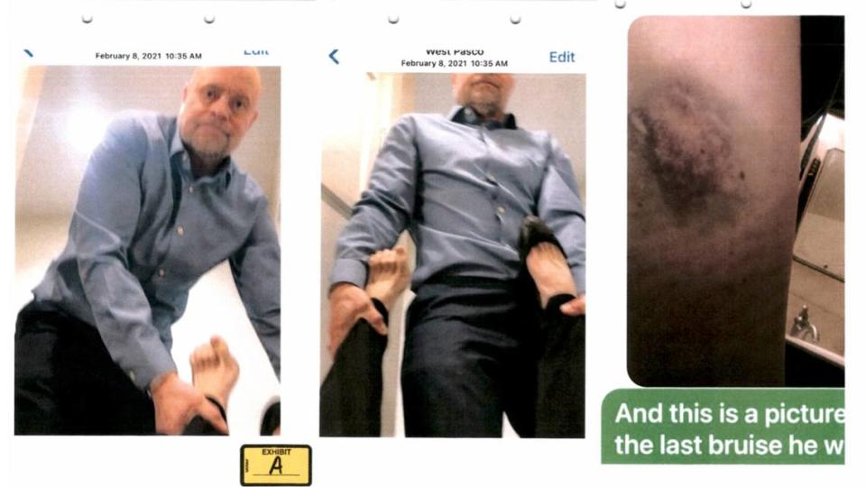 The former wife of Superior Court Judge Sam Swanberg submitted these photos in a court filing claiming he dragged her out of a room against her will in February 2021.