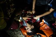 An injured migrant reacts as he receives medical care after refugees and migrants arrived on the Greek island of Lesbos after crossing the Aegean Sea from Turkey on October 8, 2015