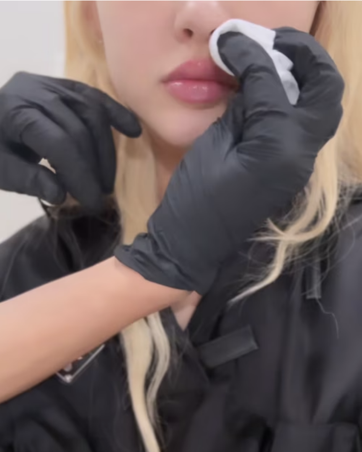 Alabama Barker has a lip treatment applied by someone in black gloves