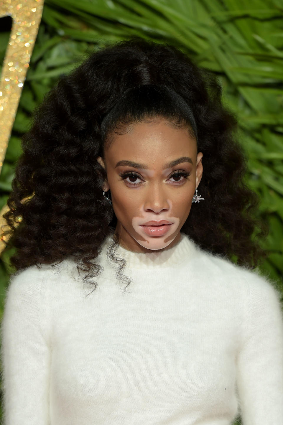 Winnie Harlow