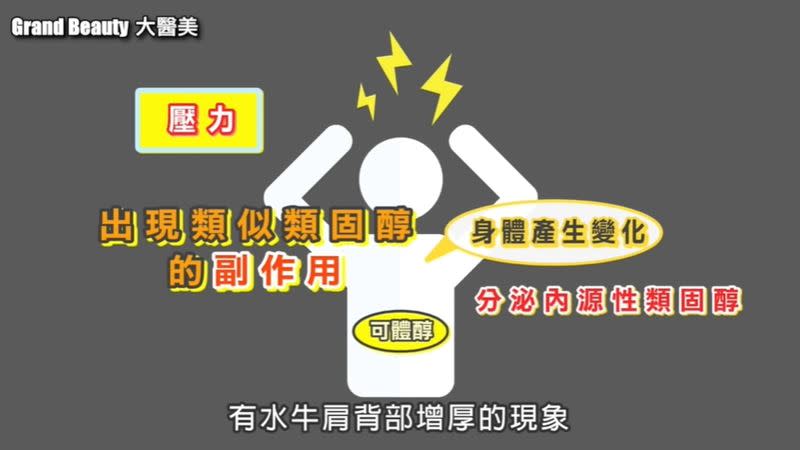 邱正宏醫師表示，有些身體上的免疫疾病，必須服用類固醇，而類固醇的副作用也會造成背部增厚的現象。（圖／翻攝自《Grand Beauty 大醫美》YouTube頻道）