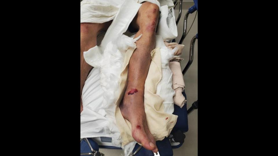 Johnathan Scaletty, of Lee&#x002019;s Summit, said he was attacked in the parking lot of Arrowhead Stadium ahead of the Luke Combs concert on Saturday. It took an ambulance about an hour to arrive, said Scaletty, who suffered multiple broken bones in his ankle.