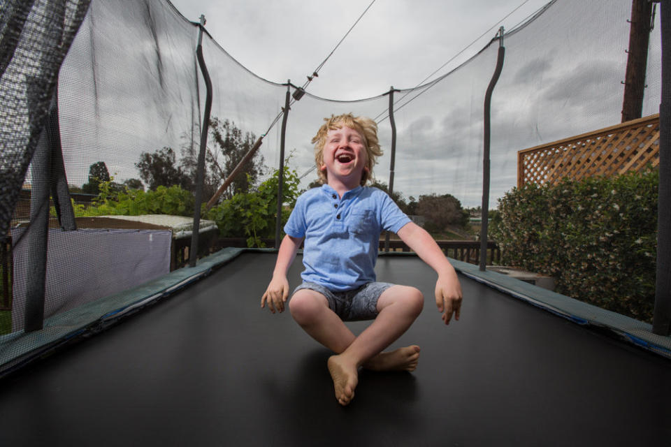 Ian is a fun-loving boy who has&nbsp;<a href="https://ghr.nlm.nih.gov/condition/megalencephaly-capillary-malformation-syndrome" target="_blank">megalencephaly-capillary malformation syndrome</a> (MCAP) and <a href="https://ghr.nlm.nih.gov/condition/polymicrogyria" target="_blank">polymicrogyria</a>&nbsp;(PMG), which involve the skin, connective tissue and brain causing a disproportionately large head and capillary malformations on the skin. (Photo: <a href="http://karenhaberberg.com/" target="_blank">Karen Haberberg</a>)